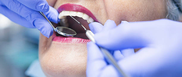 Best Knocked-Out Tooth (Avulsed Tooth) Treatment in Woodburn, IN